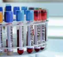 Analiza transaminazei sângelui