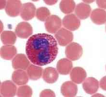 Ce este eozinofilele, și că ele arată într-un test de sânge