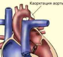 Coarcta de aorta si tratamentul acesteia