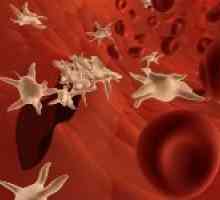 Ce se întâmplă dacă trombocitele din sânge a crescut și dacă este periculos?