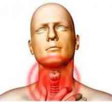 Care este boala hipotiroidism subclinic