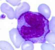 Arată că monocitele într-un test de sânge?