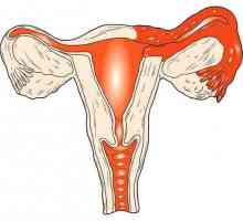 Gidrosalpinksa: încălcarea permeabilității trompelor uterine