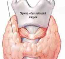 Hipotiroidismul tiroidă la copii
