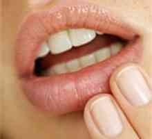 Cum să eliminați rapid leziuni herpetice pe buze