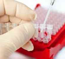 Ce teste de sânge sunt tratate cu hipotiroidism și ce boli pot detecta?