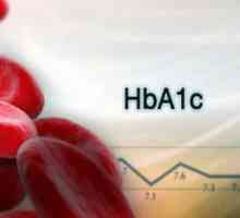 Norma hemoglobinei glicozilate la pacienții cu diabet zaharat