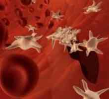 Motivele pentru declinul de trombocite din sânge și creșterea acestora