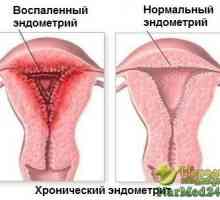 Puterea de plante în tratamentul endometrita