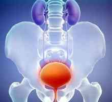 Simptomele de inflamație a vezicii urinare (cistită)