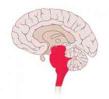Accident vascular cerebral stem: tipuri (ischemic, hemoragic), cauze, simptome, tratament,…