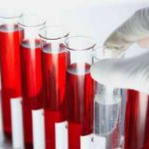 Analiza unui sânge pe TTG