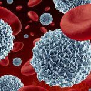 Cum de a reduce celulele albe din sânge