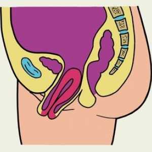 Omiterea uterului si vaginului