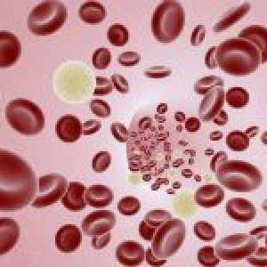 Motive și metode de tratare a leucocitelor din sânge