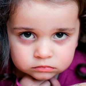 Cauzele vânătăi și cercurile intunecate de sub ochii copilului