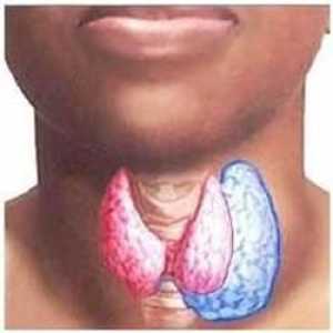 Simptome, diagnostic și tratament al tumorilor tiroidiene
