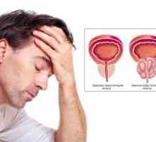 Adenomul de prostata: simptome si stadiul bolii