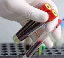 Analiza clinică a sângelui desfășurat: scopul și transcrierea analizei