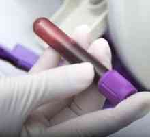 Un test de sânge pentru nvcor anti: numire și decodare