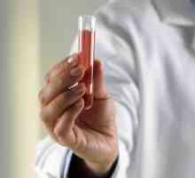 Un test de sânge pentru a stării imune: indicații și caracteristici ale