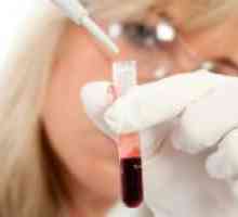 Un test de sânge pe emf