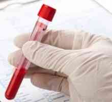 Un test de sânge pentru opisthorchiasis - preparare, procedura, decodificare și tratamentul bolilor…