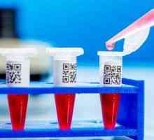 Analizele de sânge asupra celulelor canceroase, și interpretarea