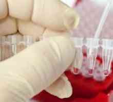 Cât de multe leucocite în sânge este considerat normal și ceea ce depinde de