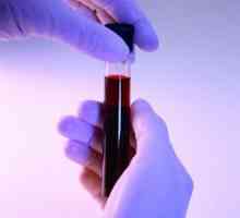 Testul de sange pentru factorul reumatoid este funcția de decodificare de valoare și de analiză