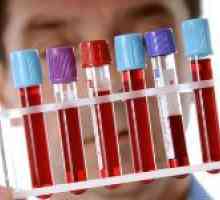 Test de sange pentru cancerul de vezică urinară și interpretarea