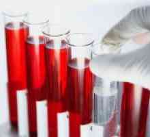 Analiza unui sânge pe TTG