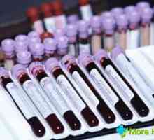 Un test de sânge în timpul sarcinii: descifrarea indicatorilor de bază