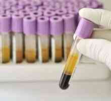 Test de sange Petit: decodificare, deviațiile rata
