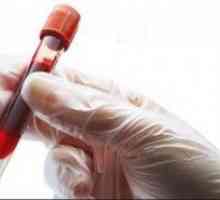Un test de sânge pentru ESR Westergren: ce este? În cazul în care sunt crescute regulile, ceea ce…