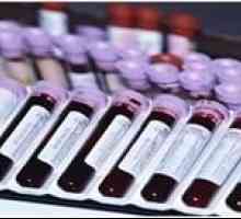Analiza TTG și pregătirea pentru donarea de sânge