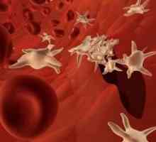 Analizele au arătat că trombocitele reduse în sânge, ceea ce înseamnă și cum să ridice nivelul de…