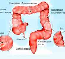 Structura anatomica, bolile și tratamentul colonului sigmoid
