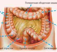 Anatomia și boli ale colonului