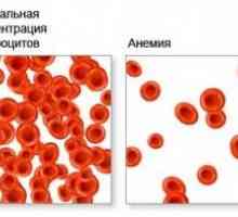Anemia in timpul menstruatiei 10