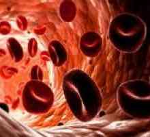 Principalele motive pentru nivelurile scăzute ale hemoglobinei din sânge