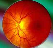 Ochii angiopatie retiniene la copii
