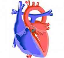 Stenoza aortică / defect: cauze, simptome, intervenții chirurgicale, prognosticul