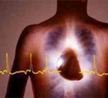 Sinus (sinus), bătăi neregulate ale inimii