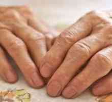Artrita degetelor: terapii tradiționale