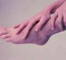 Vase angiopatie ale picioarelor (inferioare)