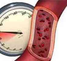 Hipertensiune labila (tensiune arterială ridicată)