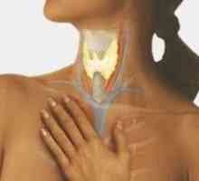 Hipotiroidism autoimuna ca urmare a tiroidita
