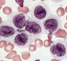 Bazofile în sânge