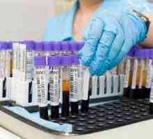 Teste de sânge biochimice: decodificarea tabelul pentru valorile principale ale